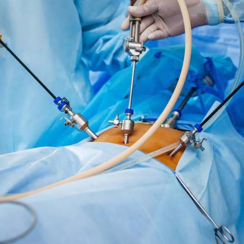 Curso Masterclass Laparoscopia en Piso Pélvico • Sin Membresía